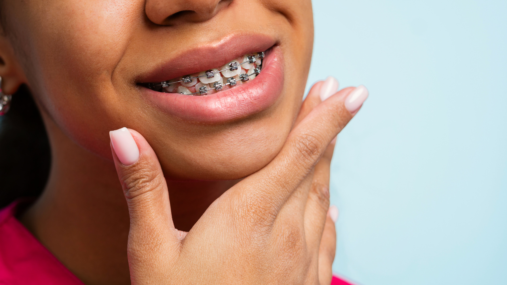 Orthodontic Treatment. Teeth with Braces